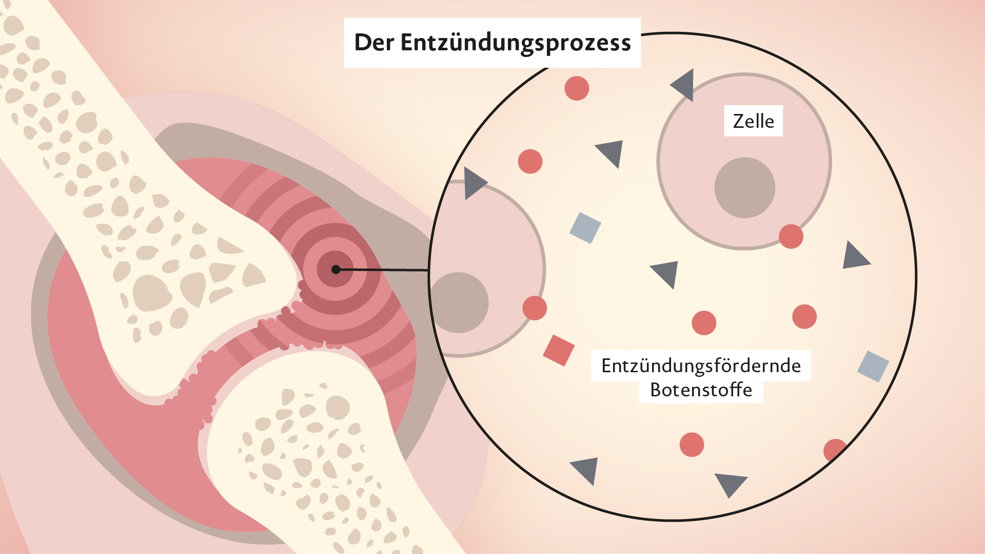 Rinvoq Wirkweise bei Rheumatoider Arthritis