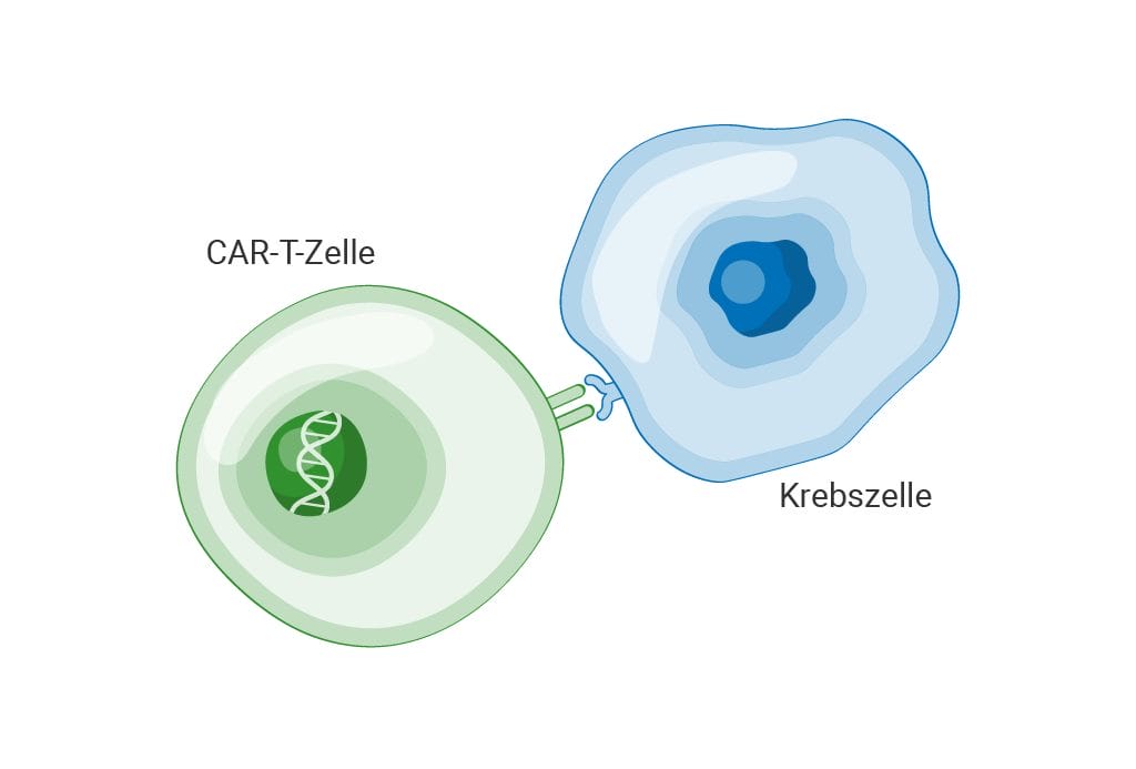 Darstellung der CAR-T-Zelltherapie beim follikulären Lymphom